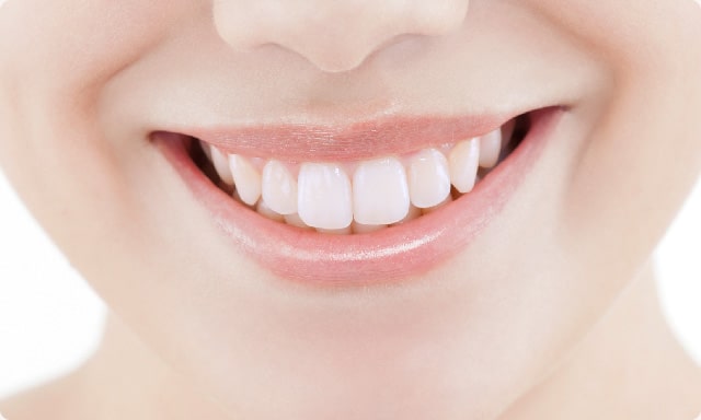3｜歯並びの長期的な安定 写真