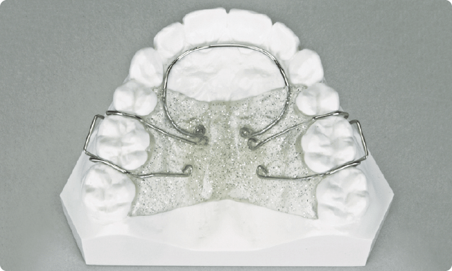 使用装置例1：弾線付きプレート（上あごに装着） 写真